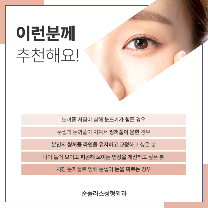 For Eye Shape Changes Through Midlife Eyelid Drooping Surgery image 5