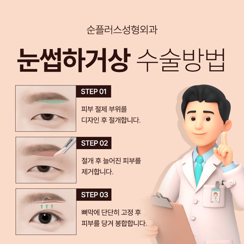 Eyebrow Lift Surgery Chosen by Celebrities for a Natural Youthful Effect image 5