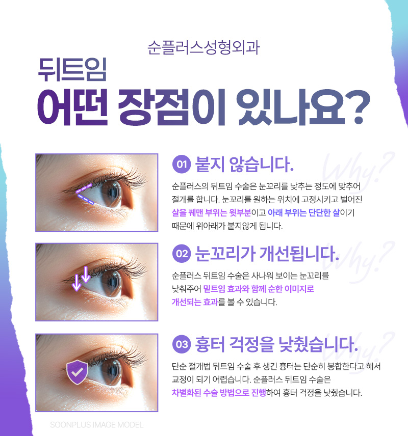 Lateral Canthoplasty (Outer Corner Surgery): Expanding the Horizontal Length While Lowering the Outer Eye Corner for a More Open Look image 3