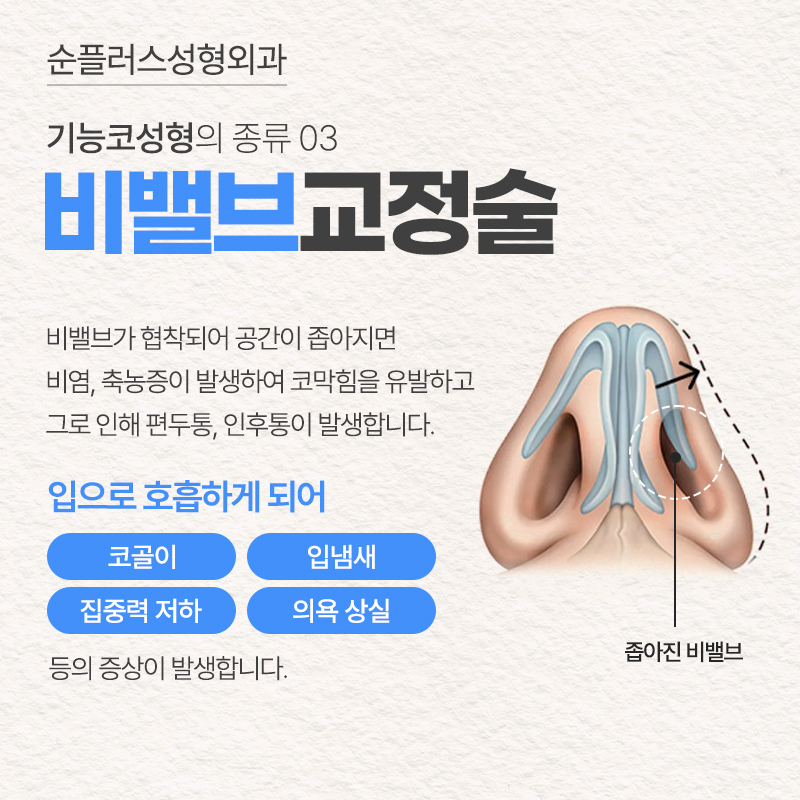 기능코수술 미용적 개선과 비염 비중격만곡증 개선으로 편안한 숨길 관련 이미지 5