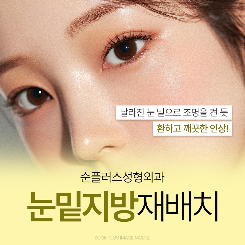 눈밑지방재배치 수술로 칙칙한 다크써클 개선할 수 있나요? 관련 이미지 1