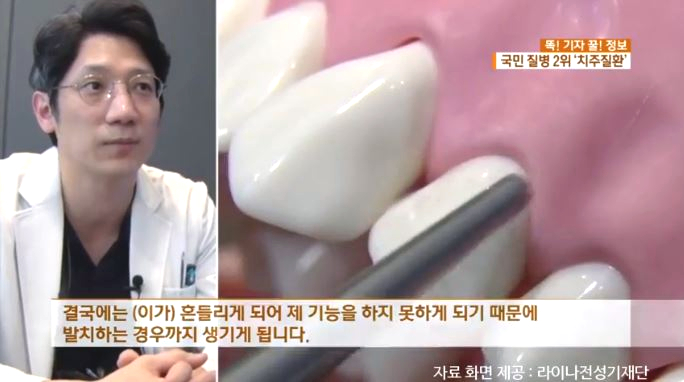 [KBS 아침 뉴스타임] 정재욱원장님 치주질환 인터뷰 방영 (2019. 2. 12) 관련 이미지 3