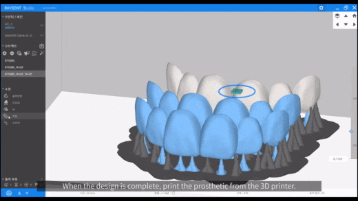 3D 안면스캔, 페이스 스캐너(Face scanner) 도입안내 관련 이미지 5