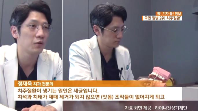 [KBS 아침 뉴스타임] 정재욱원장님 치주질환 인터뷰 방영 (2019. 2. 12) 관련 이미지 2