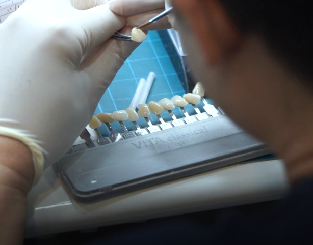 연세굿데이치과 기공세미나 PART 2. shade taking 관련 이미지 5