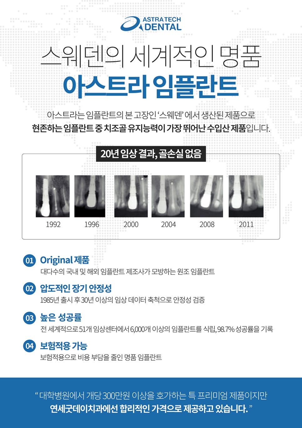아스트라 임플란트(Astra implant) &ndash; 스웨덴산과 국산의 차이점!? 관련 이미지 5