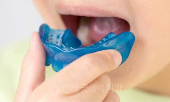 프리올소 장치안내 (ft. 어린이 부정교합 교정 편) 관련 이미지 1