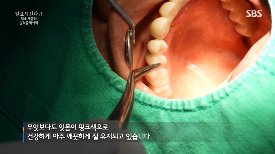 박정철 원장님 SBS 일요특선 다큐멘터리 자문의 출연 관련 이미지 6