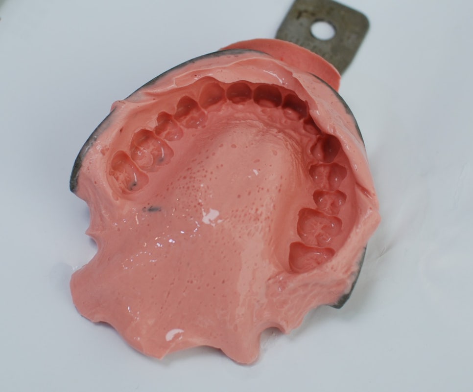 아이테로(iTero) 구강스캐너로 교정전후 시뮬레이션 결과를 확인하실 수 있습니다. 관련 이미지 3