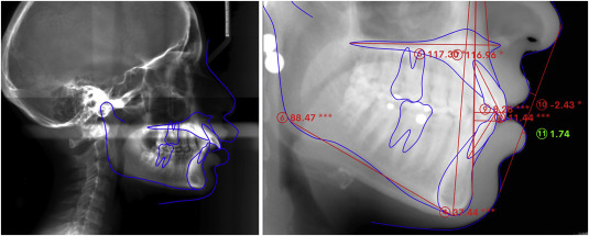 Yonsei Good Day Dental Clinic Operates WebCeph Diagnostics to Predict Pre- and Post-Orthodontic Changes image 2