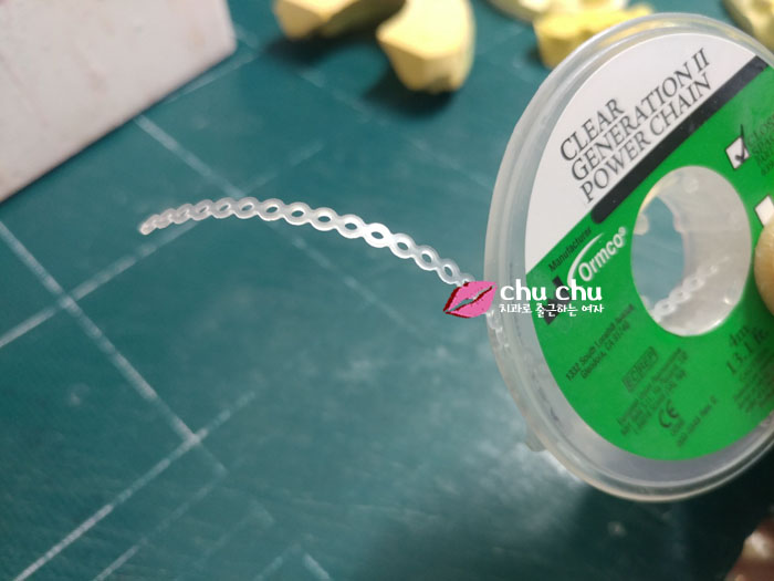 [ 교정4개월 ] 치아교정 파워체인 상/하악 모두 완료 관련 이미지 3