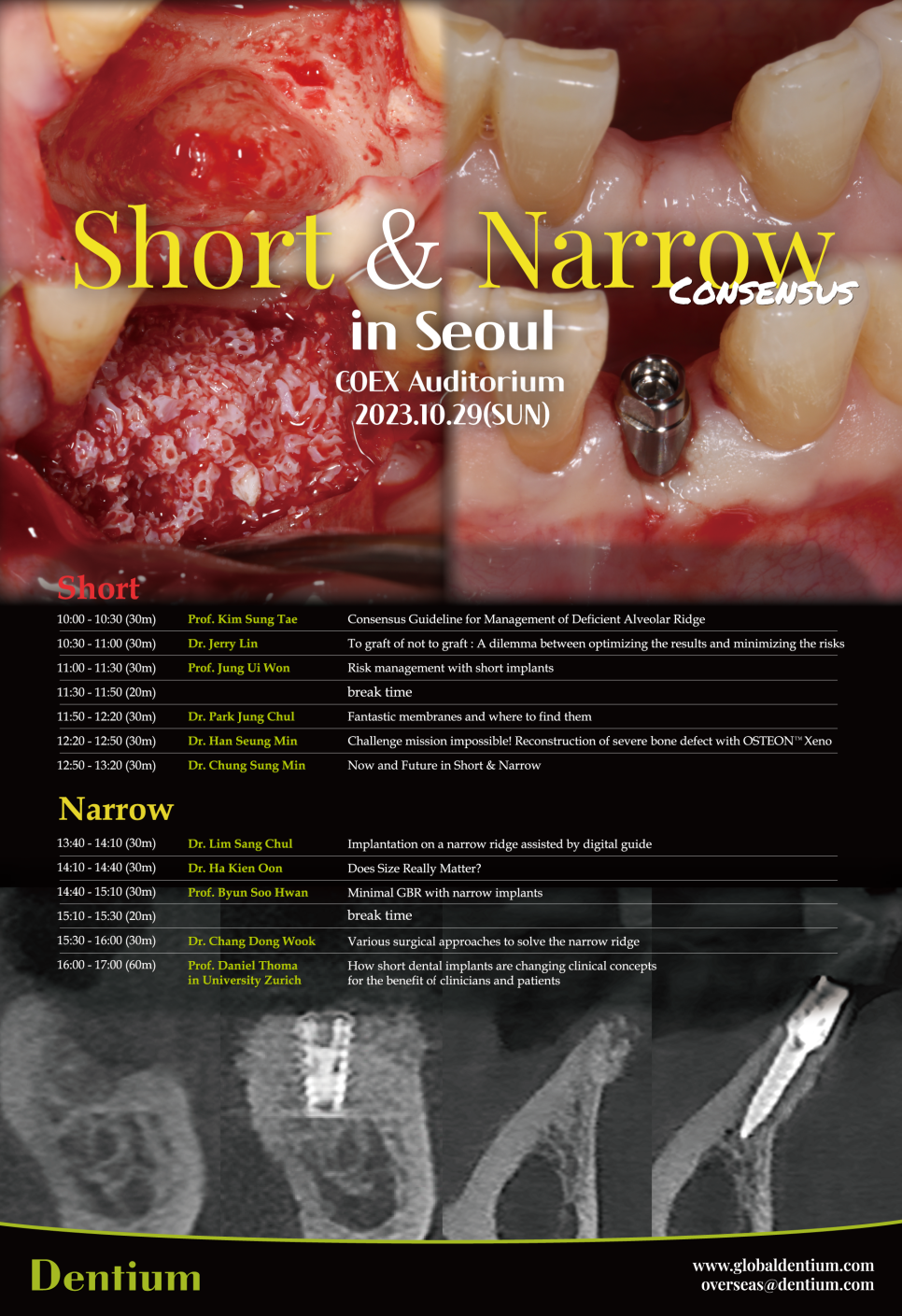 박정철 원장, 서울코엑스에서 개최된 급속골이식(i-GBR)강연현장 관련 이미지 1