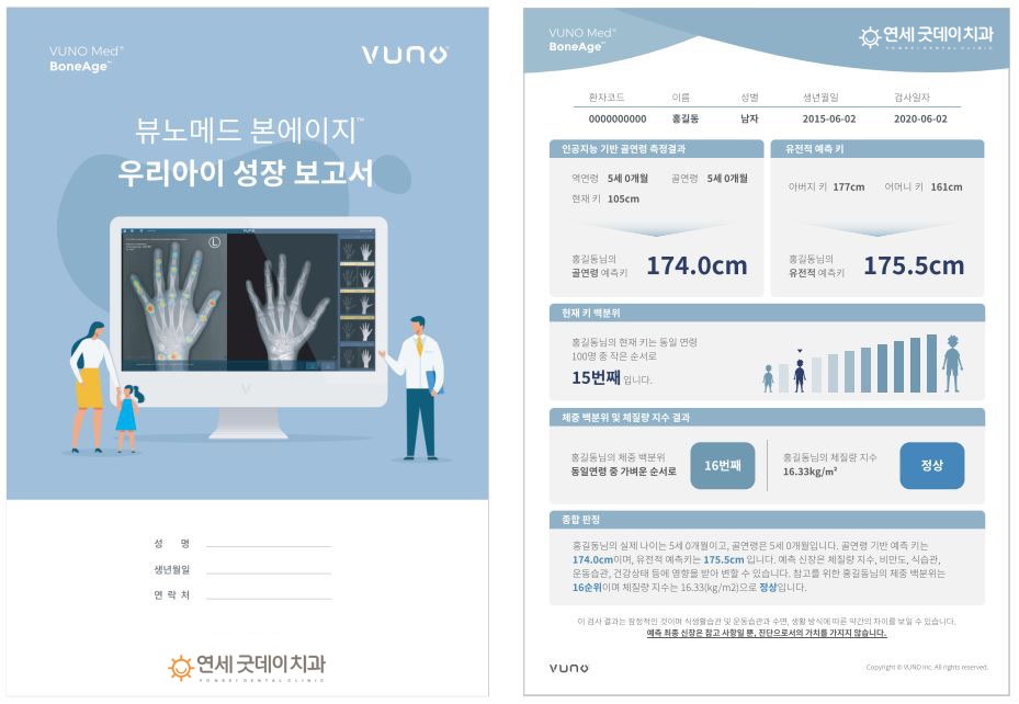 연세굿데이치과] 성장판 검사가 중요한 이유 관련 이미지 8