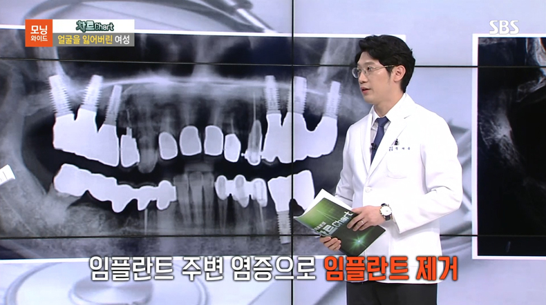 정재욱 원장님 SBS 출연 관련 이미지 4