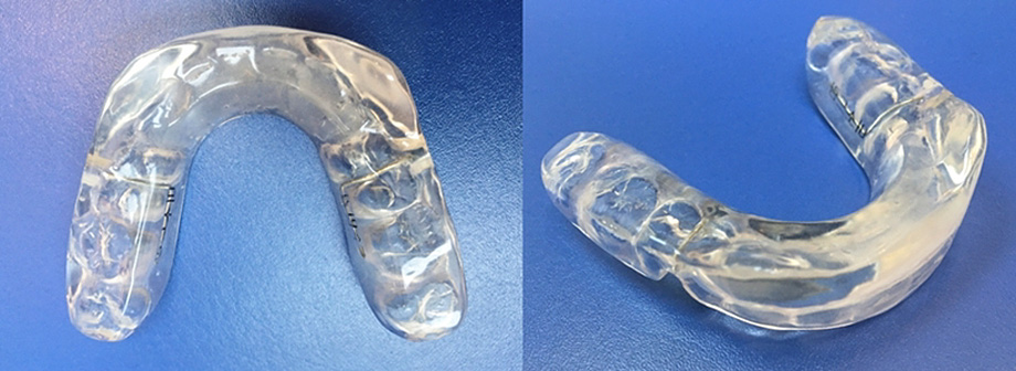 Yonsei Goodday Dental Clinic: Orthodontic Treatment Considering CO-CR Discrepancy image 4