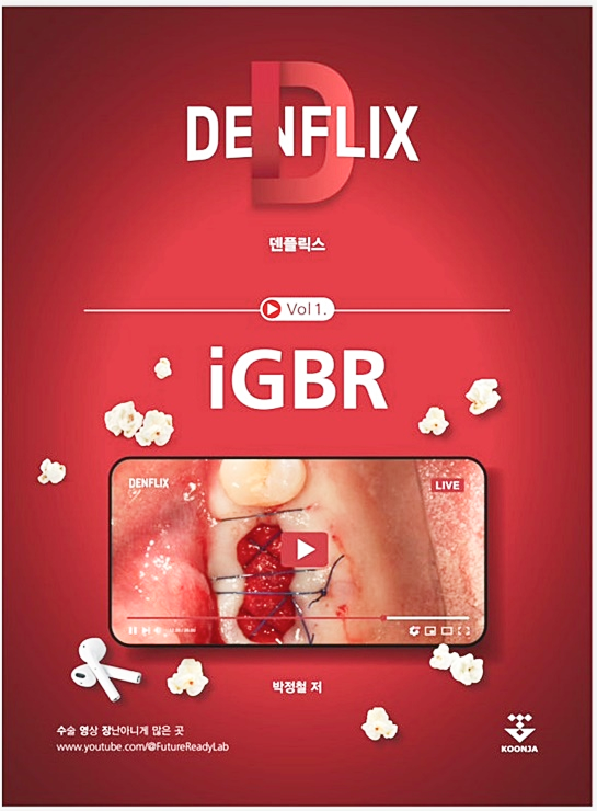 덴플릭스 iGBR(급속 골이식)이 모어덴 우수도서로 선정되었습니다! 관련 이미지 1
