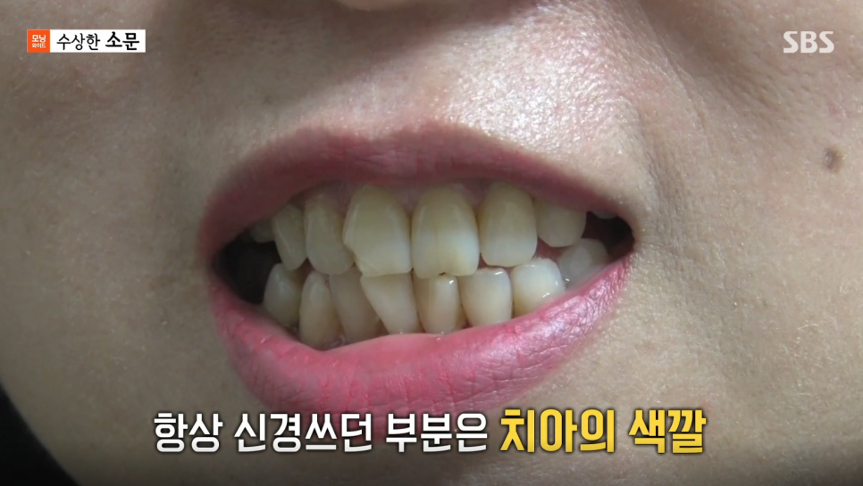 연세굿데이치과 강민경원장님, SBS 모닝와이드 <수상한 소문> 자문의 출연 관련 이미지 2