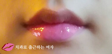 입술볼륨감을 위한 데일리 립글로스, 미샤 더 스타일 글램 핏 립글로스 관련 이미지 10