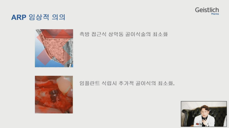 [Dr.정재욱] 치조제보존술(ARP) 유튜브 실시간 온라인강연 관련 이미지 15