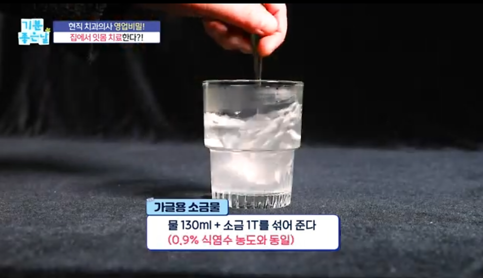 박정철 원장님 MBC 기분좋은날 방송 방영 관련 이미지 18