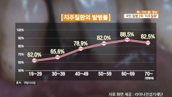 [KBS 아침 뉴스타임] 정재욱원장님 치주질환 인터뷰 방영 (2019. 2. 12) 관련 이미지 4