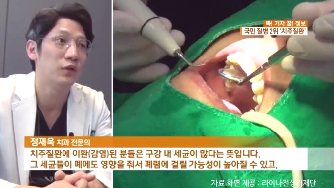 [KBS 아침 뉴스타임] 정재욱원장님 치주질환 인터뷰 방영 (2019. 2. 12) 관련 이미지 5