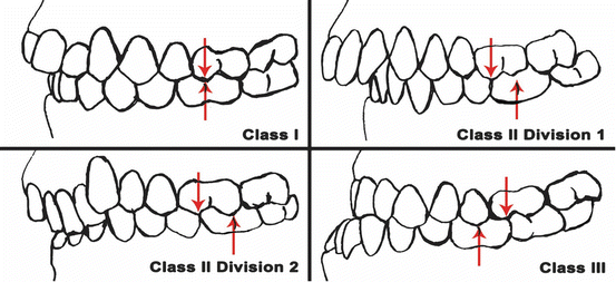 Yonsei Goodday Dental Clinic: Orthodontic Treatment Considering CO-CR Discrepancy image 2