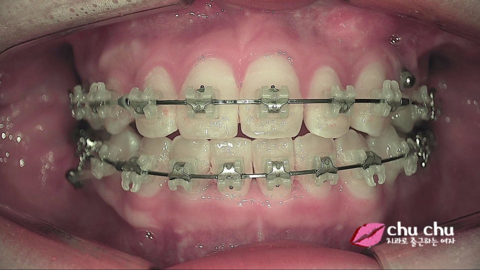 큐레이(Q-ray) &ndash; 플라그형광검사 시스템을 도입했습니다 :) 관련 이미지 6