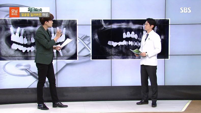 정재욱 원장님 SBS 출연 관련 이미지 3
