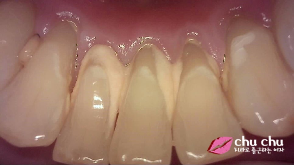 큐레이(Q-ray) &ndash; 플라그형광검사 시스템을 도입했습니다 :) 관련 이미지 2
