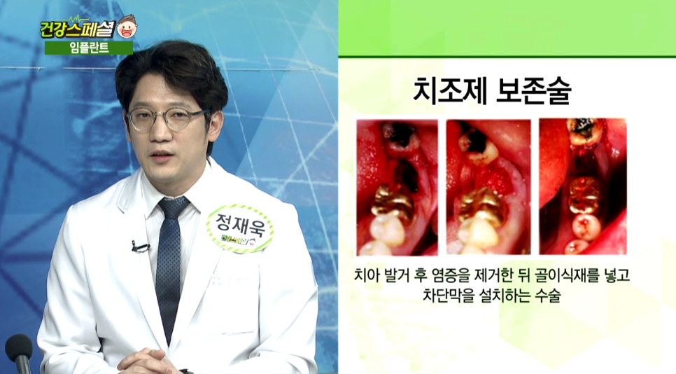 매일경제TV <건강스페셜> 임플란트 성공의 열쇠 - 정원장님 자문의 출연 관련 이미지 10