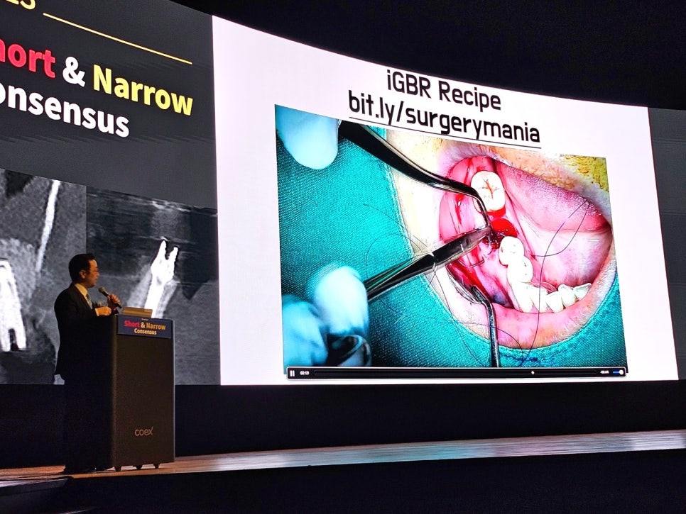 박정철 원장, 서울코엑스에서 개최된 급속골이식(i-GBR)강연현장 관련 이미지 3