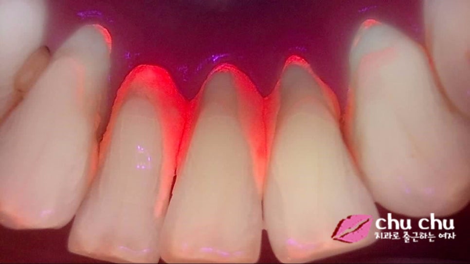 큐레이(Q-ray) &ndash; 플라그형광검사 시스템을 도입했습니다 :) 관련 이미지 3