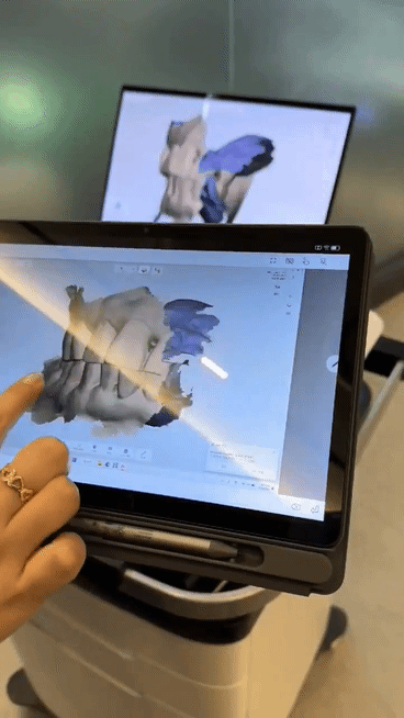 3Shape 트리오스5 구강스캐너 장비 추가 도입했습니다 관련 이미지 7