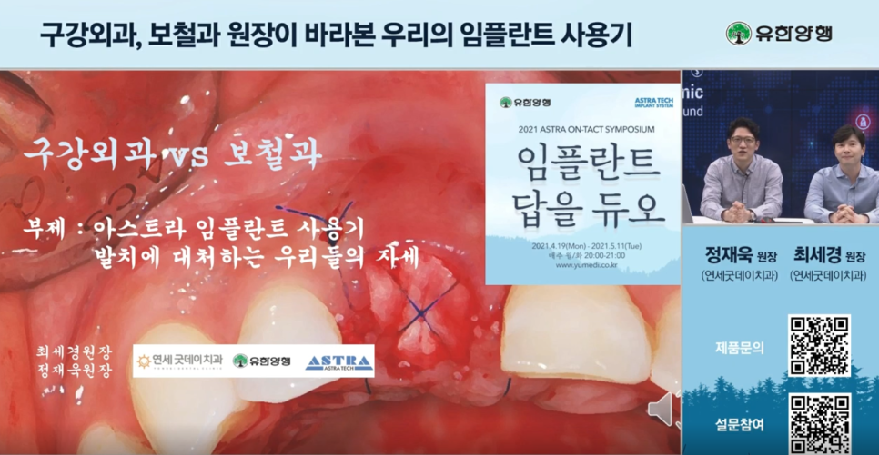 치과의사 대상 정재욱, 최세경원장님 생방송 강의 (유한양행 "임플란트 답을 듀오") 관련 이미지 6