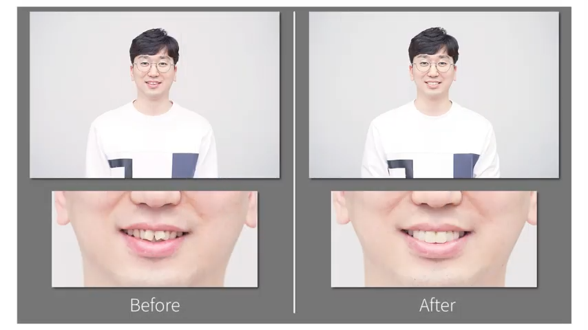 3D 안면스캔, 페이스 스캐너(Face scanner) 도입안내 관련 이미지 8