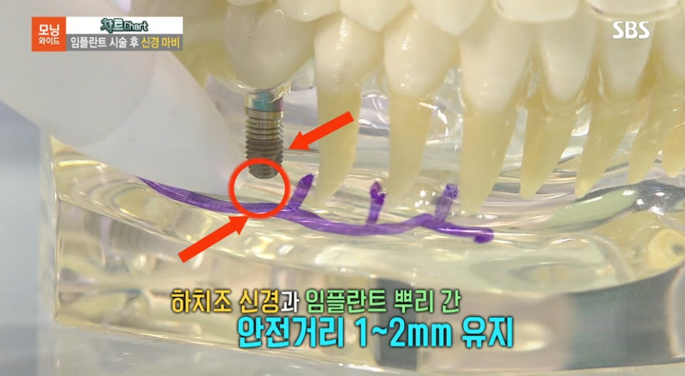 [2018.08.23] SBS모닝와이드 - 수서 연세굿데이 최세경 원장님 방송캡쳐 관련 이미지 13