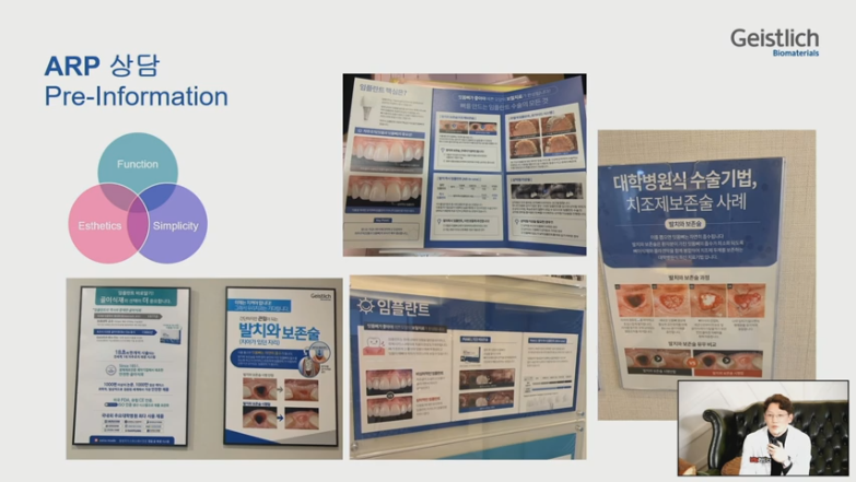 [Dr.정재욱] 치조제보존술(ARP) 유튜브 실시간 온라인강연 관련 이미지 19