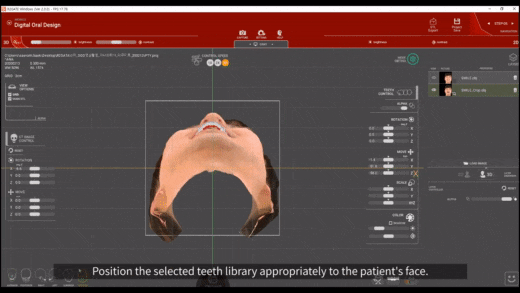 3D 안면스캐너(RAYFace) 도입 소식을 전해드립니다! 관련 이미지 4
