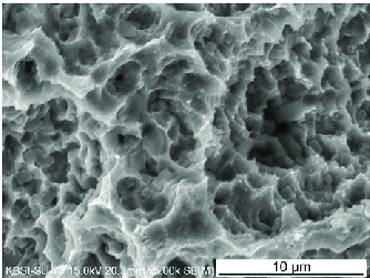 스트라우만 임플란트 탁월한 장기안정성 (ft. 70주년의 역사) 관련 이미지 3