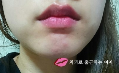 거친 입술을 촉촉하게, 입술팩, 건조한 입술관리법으로 굿! 꾸준히 쓰려구요~ 관련 이미지 9