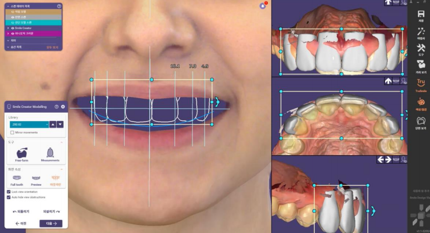 3D 안면스캔, 페이스 스캐너(Face scanner) 도입안내 관련 이미지 3