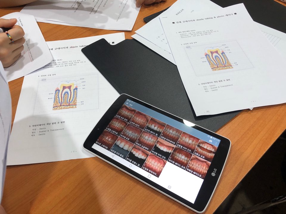 연세굿데이치과 기공세미나 PART 2. shade taking 관련 이미지 4