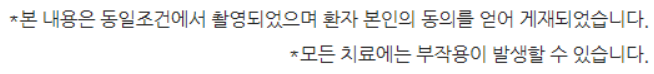 치아중심선 비대칭 교정 관련 이미지 10