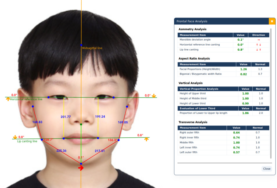 Yonsei Good Day Dental Clinic Operates WebCeph Diagnostics to Predict Pre- and Post-Orthodontic Changes image 3