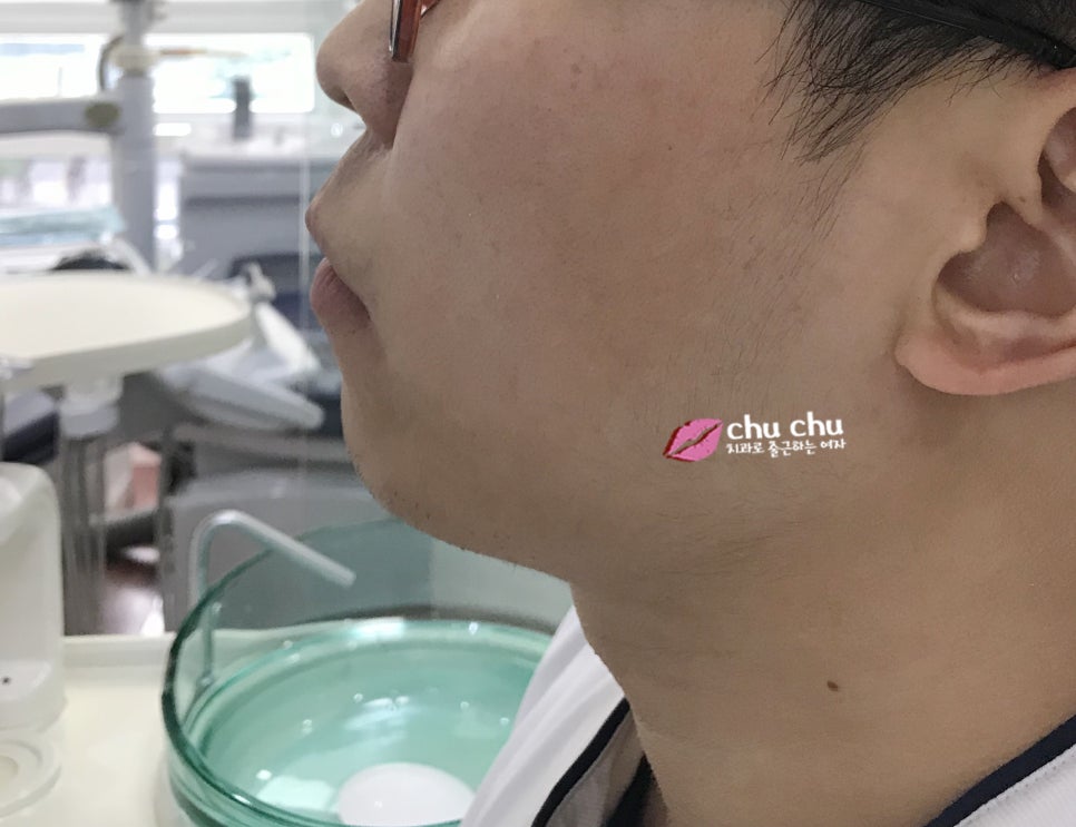 튀어나온 입 변화과정 (2018.03 ~) 관련 이미지 4