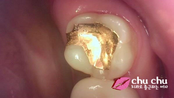 큐레이(Q-ray) &ndash; 플라그형광검사 시스템을 도입했습니다 :) 관련 이미지 4