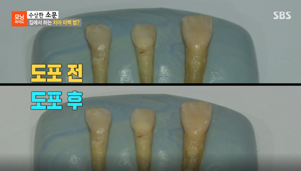 연세굿데이치과 강민경원장님, SBS 모닝와이드 <수상한 소문> 자문의 출연 관련 이미지 9