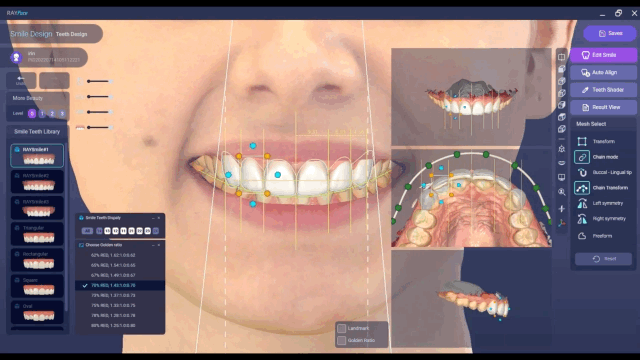 3D 안면스캐너(RAYFace) 도입 소식을 전해드립니다! 관련 이미지 3