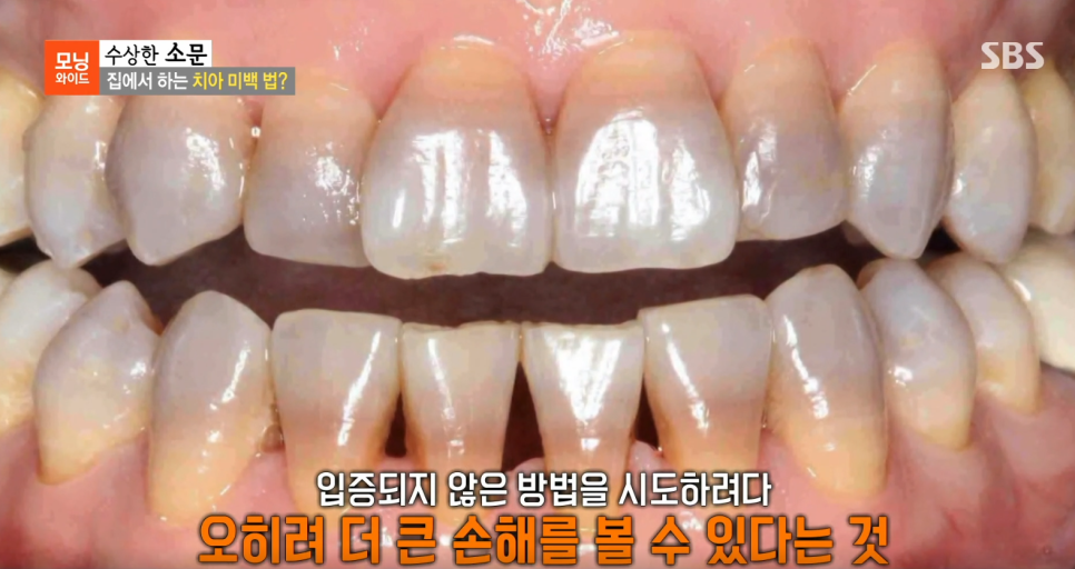 연세굿데이치과 강민경원장님, SBS 모닝와이드 <수상한 소문> 자문의 출연 관련 이미지 13